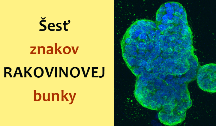 Šesť charakteristických znakov rakovinovej bunky