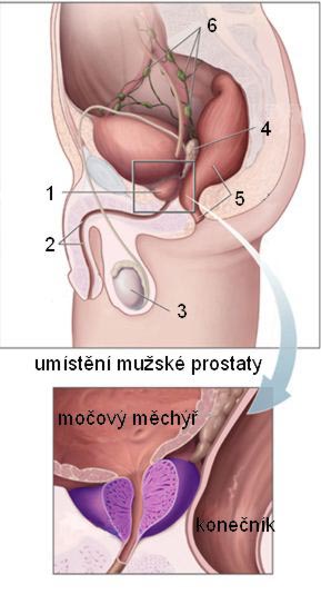 https://commons.wikimedia.org/wiki/File:Anatomie_prostaty.jpg